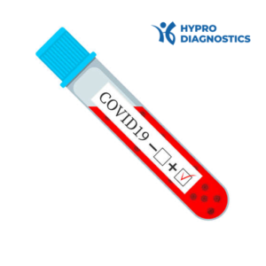 COVID19 test tube