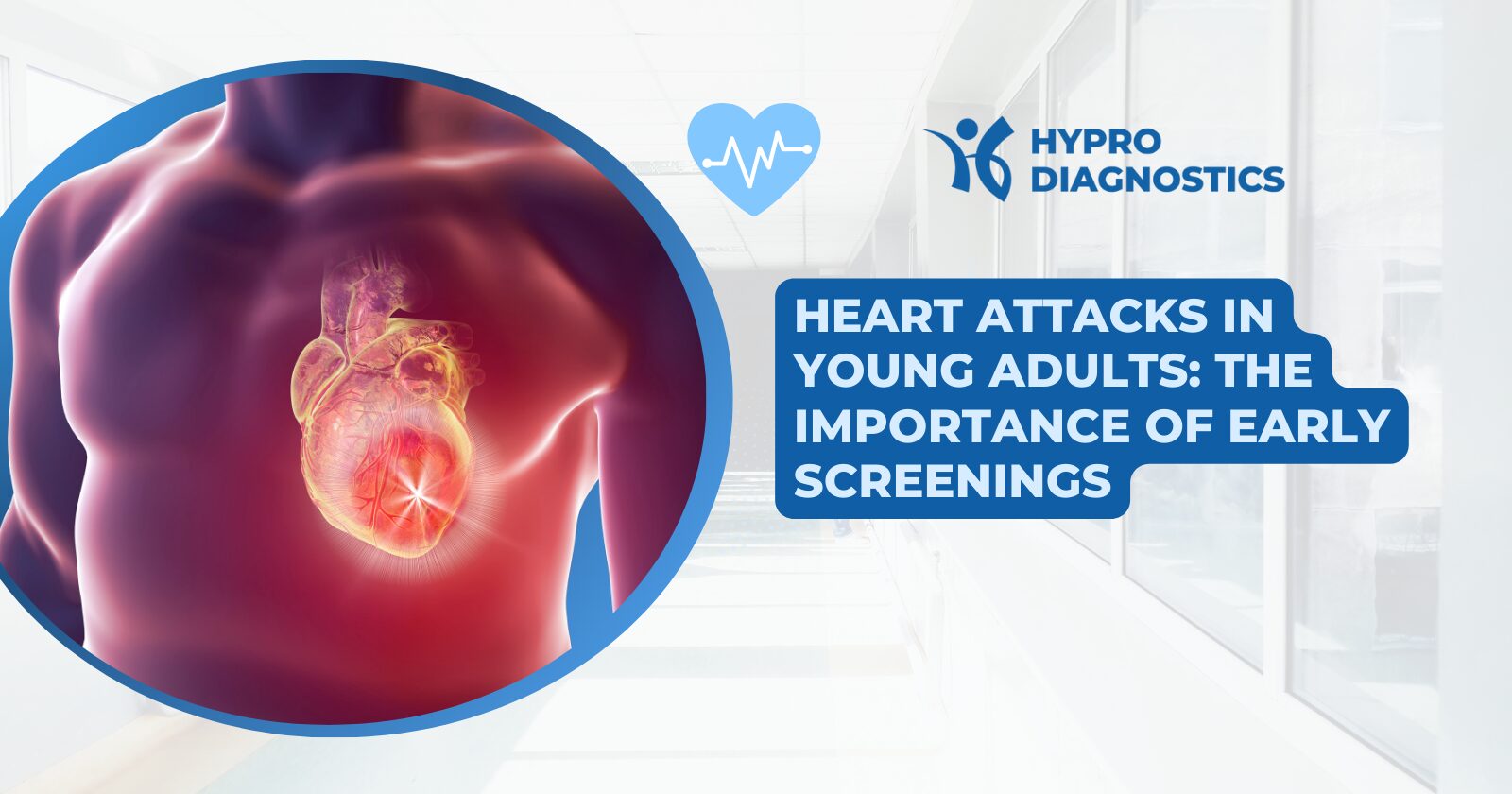 heart attacks in young adults